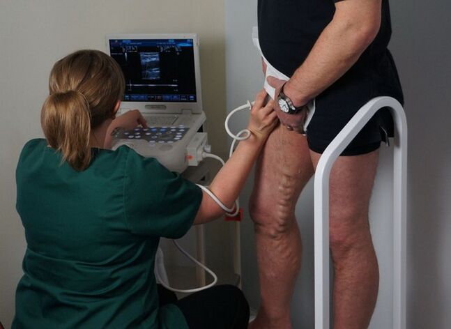 испитување на вените пред ласерска коагулација за проширени вени